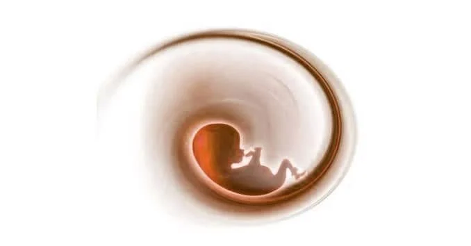 abortion-3 Opna grein